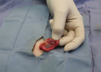 Comprehensive Insights into the Essential Health Benefits of Nip and Tuck Surgeries for Pets