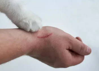 cat scratch disease in cats | Exploring the Infrequent Occurrence of Cat Scratch Disease in Felines: Key Insights on Symptoms, Transmission, and Prevention for Pet Owners to Keep Their Cats Healthy and Safe. | Understanding the Rarity of Cat Scratch Disease in Cats